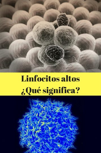 LINFOCITOS ALTOS: ¿QUÉ SIGNIFICA?